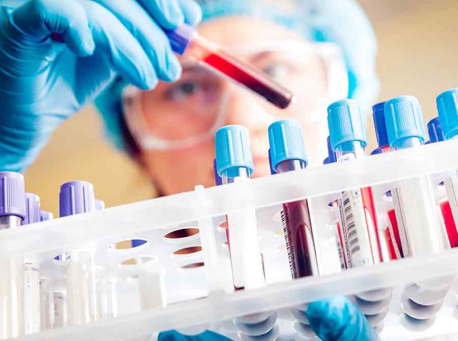 Service https://tmblab.vn/wp-content/uploads/2020/03/service_3.jpg